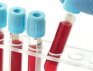 Xét nghiệm, Chẩn đoán tiền ung thư